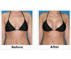 BREAST ENLARGEMENT OR ENHANCEMENT +27605775963 CREAM AND PILLS